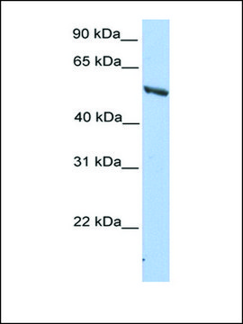 Anti-IMPDH2 antibody produced in rabbit affinity isolated antibody