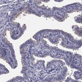 Anti-CCDC40 antibody produced in rabbit Prestige Antibodies&#174; Powered by Atlas Antibodies, affinity isolated antibody, buffered aqueous glycerol solution