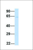 Anti-YTHDF3 (ab1) antibody produced in rabbit affinity isolated antibody