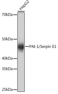 Anti-PAI-1/Serpin E1 Antibody, clone 6L6Y7, Rabbit Monoclonal