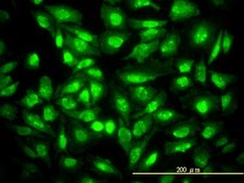 Monoclonal Anti-CDKN1B antibody produced in mouse clone 4B4-E6, purified immunoglobulin, buffered aqueous solution