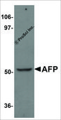 Anti-AFP antibody produced in rabbit affinity isolated antibody, buffered aqueous solution