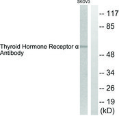 Anti-Thyroid Hormone Receptor &#945;, N-Terminal antibody produced in rabbit affinity isolated antibody