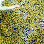 Anti-phospho-VEGFR1 (pTyr1048) antibody produced in rabbit affinity isolated antibody