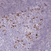Anti-ZBP1 antibody produced in rabbit Prestige Antibodies&#174; Powered by Atlas Antibodies, affinity isolated antibody, buffered aqueous glycerol solution