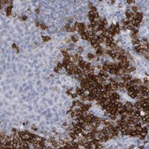 Anti-CD38 antibody produced in rabbit Prestige Antibodies&#174; Powered by Atlas Antibodies, affinity isolated antibody, buffered aqueous glycerol solution