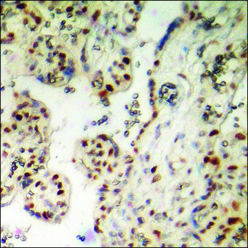 Anti-phospho-AML1 (pSer303) antibody produced in rabbit affinity isolated antibody