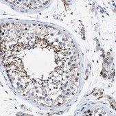 Anti-HOOK1 antibody produced in rabbit Prestige Antibodies&#174; Powered by Atlas Antibodies, affinity isolated antibody, buffered aqueous glycerol solution, Ab2