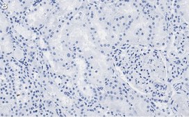 Anti-FTO Antibody, clone 4B21 ZooMAb&#174; Rabbit Monoclonal recombinant, expressed in HEK 293 cells