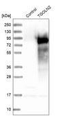 Anti-TGOLN2 antibody produced in rabbit Prestige Antibodies&#174; Powered by Atlas Antibodies, affinity isolated antibody, buffered aqueous glycerol solution