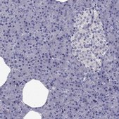 Anti-SLC6A2 Prestige Antibodies&#174; Powered by Atlas Antibodies, affinity isolated antibody