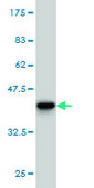Monoclonal Anti-S100A7 antibody produced in mouse clone 3A5, purified immunoglobulin, buffered aqueous solution