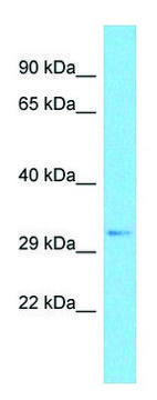 Anti-SRRM2 (C-terminal) antibody produced in rabbit affinity isolated antibody