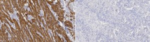 Anti-Myosin-11 Antibody, clone 1L21 ZooMAb&#174; Rabbit Monoclonal recombinant, expressed in HEK 293 cells
