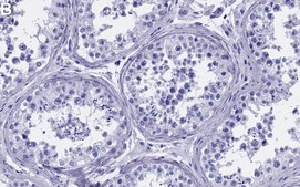 Anti-CBX1 Antibody, clone 1D7 ZooMAb&#174; Rabbit Monoclonal recombinant, expressed in HEK 293 cells