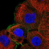Anti-MAP2K1 antibody produced in rabbit Prestige Antibodies&#174; Powered by Atlas Antibodies, affinity isolated antibody, buffered aqueous glycerol solution
