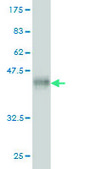 Monoclonal Anti-C3 antibody produced in mouse clone 5F9, purified immunoglobulin, buffered aqueous solution