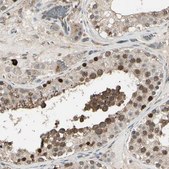 Anti-NUAK2 antibody produced in rabbit Prestige Antibodies&#174; Powered by Atlas Antibodies, affinity isolated antibody, buffered aqueous glycerol solution