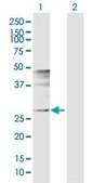 Anti-FOSL1 antibody produced in rabbit purified immunoglobulin, buffered aqueous solution