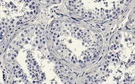 Anti-Ku70/XRCC6 Antibody, clone 1D19-L1 ZooMAb&#174; Rabbit Monoclonal recombinant, expressed in HEK 293 cells