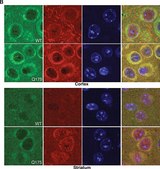 Anti-Huntingtin (N-terminal) antibody produced in rabbit affinity isolated antibody, buffered aqueous solution