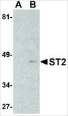 Anti-ST2 antibody produced in rabbit affinity isolated antibody, buffered aqueous solution