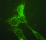Anti-LAMP2 antibody produced in rabbit affinity isolated antibody, buffered aqueous solution