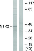 Anti-NTR2 antibody produced in rabbit affinity isolated antibody