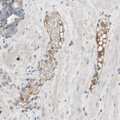 Anti-IL1RL1 antibody produced in rabbit Ab2, Prestige Antibodies&#174; Powered by Atlas Antibodies, affinity isolated antibody, buffered aqueous glycerol solution