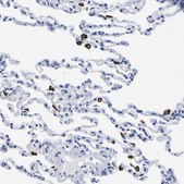 Anti-HLA-DQA1 antibody produced in rabbit Prestige Antibodies&#174; Powered by Atlas Antibodies, affinity isolated antibody, buffered aqueous glycerol solution