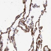 Anti-AOC3 antibody produced in rabbit Prestige Antibodies&#174; Powered by Atlas Antibodies, affinity isolated antibody, buffered aqueous glycerol solution