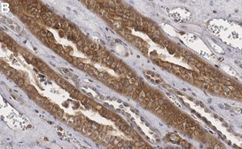 Anti-β-Arrestin 1 Antibody, clone 1B15 ZooMAb&#174; Rabbit Monoclonal recombinant, expressed in HEK 293 cells