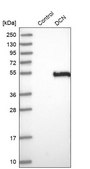 Anti-DCN antibody produced in rabbit Prestige Antibodies® Powered by Atlas Antibodies, affinity isolated antibody, buffered aqueous glycerol solution