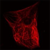 Anti-Nestin (C-terminal) antibody produced in rabbit ~1.5&#160;mg/mL, affinity isolated antibody