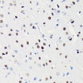 Anti-BRG1/SMARCA4 antibody produced in rabbit
