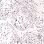 Monoclonal Anti-Tnnt2 Antibody Produced In Mouse Prestige Antibodies&#174; Powered by Atlas Antibodies, clone CL13382, affinity isolated antibody, buffered aqueous glycerol solution