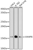 Anti-VAMP8 Antibody, clone 5H9S4, Rabbit Monoclonal