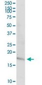 Anti-TAC1 antibody produced in rabbit purified immunoglobulin, buffered aqueous solution