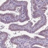 Anti-AREG antibody produced in rabbit Prestige Antibodies&#174; Powered by Atlas Antibodies, affinity isolated antibody, buffered aqueous glycerol solution