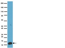 Anti-S-100 Protein Antibody, clone 15E2E2 clone 15E2E2, Chemicon&#174;, from mouse