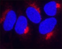 Anti-TIMP2 antibody, Mouse monoclonal clone TM8, purified from hybridoma cell culture