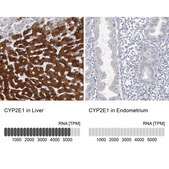 Anti-CYP2E1 antibody produced in rabbit Prestige Antibodies&#174; Powered by Atlas Antibodies, affinity isolated antibody, buffered aqueous glycerol solution