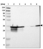 Anti-LDHB antibody produced in rabbit Prestige Antibodies® Powered by Atlas Antibodies, affinity isolated antibody, buffered aqueous glycerol solution