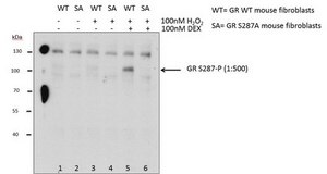Anti-phospho Glucocorticoid Receptor Antibody (Ser287) from rabbit, purified by affinity chromatography