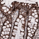 Monoclonal Anti-CS antibody produced in mouse Prestige Antibodies&#174; Powered by Atlas Antibodies, clone CL2553, purified immunoglobulin, buffered aqueous glycerol solution