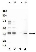 Anti-phospho-p38&#945; (Thr180/Tyr182) Antibody Upstate&#174;, from rabbit