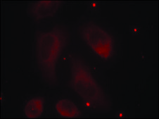 Anti-phospho-LIMK1 (pThr508) antibody produced in rabbit affinity isolated antibody