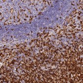 Anti-FYB antibody produced in rabbit Prestige Antibodies&#174; Powered by Atlas Antibodies, affinity isolated antibody, buffered aqueous glycerol solution