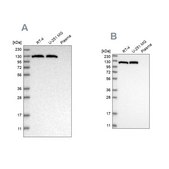 Anti-ACLY antibody produced in rabbit Prestige Antibodies&#174; Powered by Atlas Antibodies, affinity isolated antibody, buffered aqueous glycerol solution