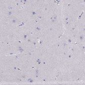 Anti-PDE6A antibody produced in rabbit Prestige Antibodies&#174; Powered by Atlas Antibodies, affinity isolated antibody